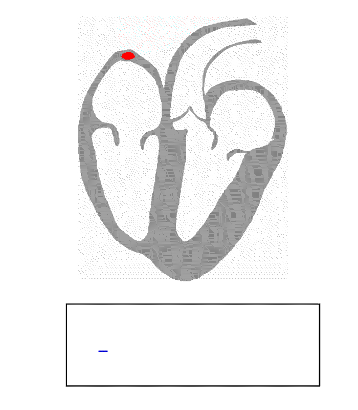 EKG-prensip (700x800)